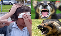 Siverek’te Kuduz Alarmı, Çoban Köpeğinin Saldırdığı 3 Çocuk Hastaneye Kaldırıldı