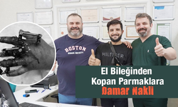 Bilekten, Kopan Parmaklara Damar Nakli Metrolife’de Yapıldı!