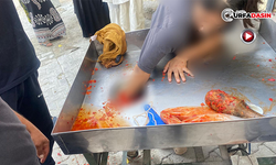 Elini Salça Makinesine Kaptırdı