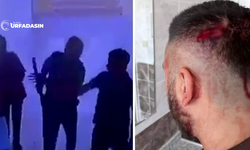 Şanlıurfa'da O Öğretmen Bakın Neden Darp Edilmiş