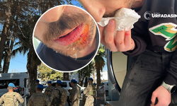 Şanlıurfa Akçakale'de Sağlık Çalışanı Darp Edildi