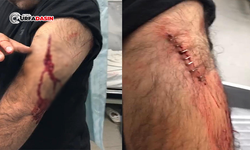 Şanlıurfa'da Sokak Ortasında Öğretmene Jiletli Saldırı