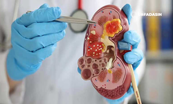 Şanlıurfalı Kadınlar Dikkat: Böbrek Taşı Görülme Oranı Arttı