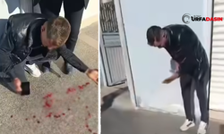 Şanlıurfa Birecik'te Kaldırımda Yürüyen Gencin Başına Beton Parçası Düştü