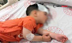 Şanlıurfa'da Başıboş Köpeklerin Saldırısına Uğrayan Çocuk Yaralandı