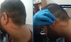 Şanlıurfa'da Sağlık Çalışanına Saldırı! Urfa'da Doktorlar İşte Bu Yüzden Kaçıyor