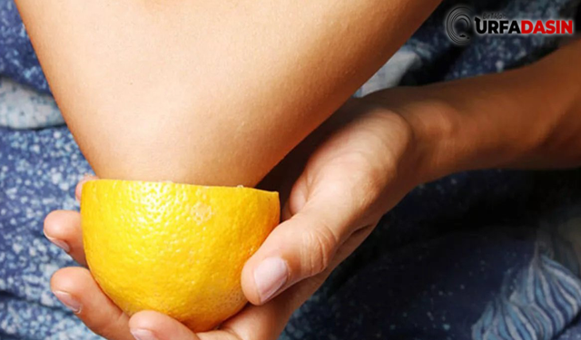 Limon sağlık için oldukça önemli. Peki posasının yararları var mı?