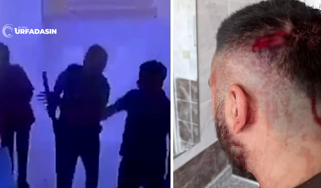 Şanlıurfa'da O Öğretmen Bakın Neden Darp Edilmiş