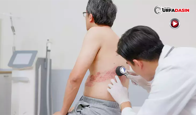 Şanlıurfa'da Zona Hastalığının Dayanılmaz Ağrıları Özel Tedaviyle Azaltılıyor