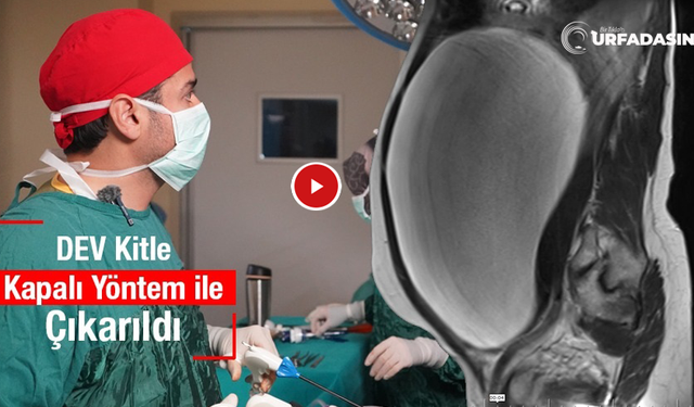 Metrolife Hastanesi'nde Dev Kitle Başarıyla Alındı: 47 Yaşındaki Kadın Sağlığına Kavuştu
