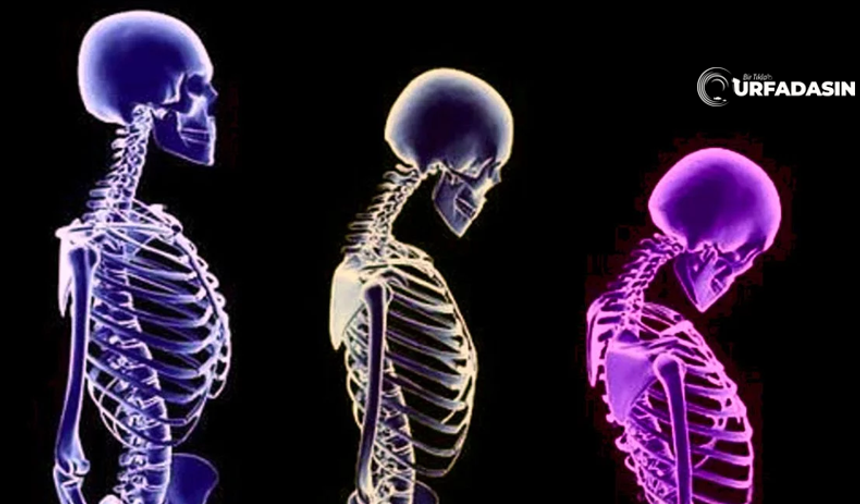 Bugün Dünya Osteoporoz Günü, Osteoporozu Es Geçmeyin
