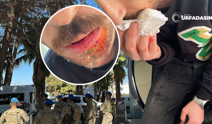 Şanlıurfa Akçakale'de Sağlık Çalışanı Darp Edildi