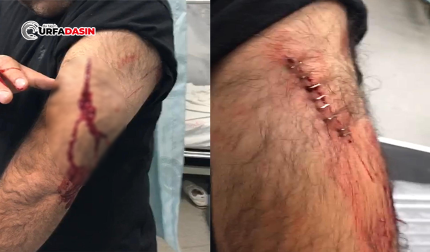 Şanlıurfa'da Sokak Ortasında Öğretmene Jiletli Saldırı