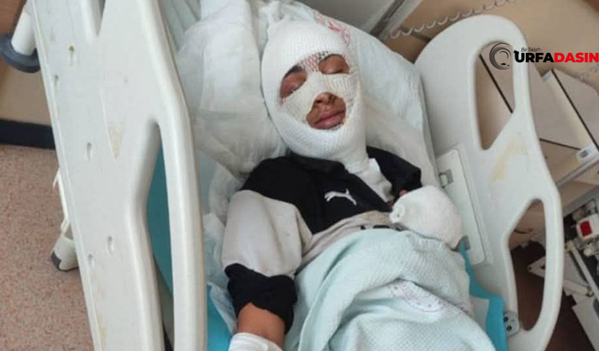 Akçakale Sanayisinde Feci Olay: İşçi Ağır Yaralandı