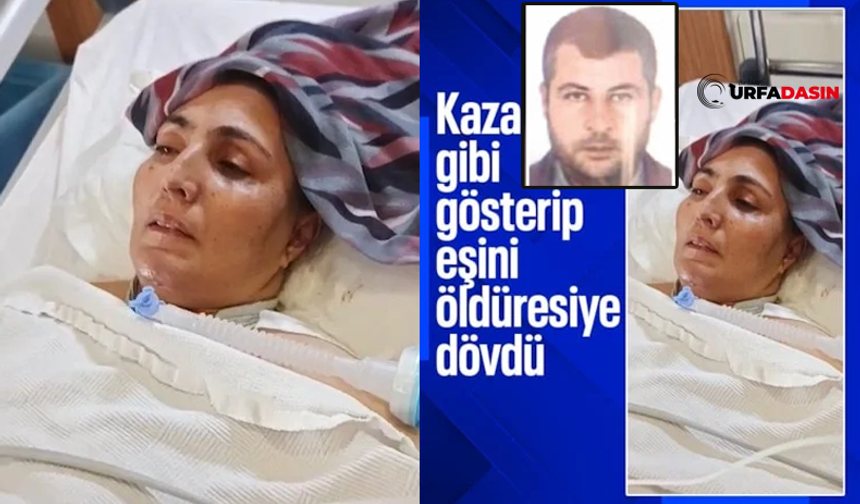 Şanlıurfa'da Eşinin Dövdüğü Kadın Yaşam Savaşı Veriyor