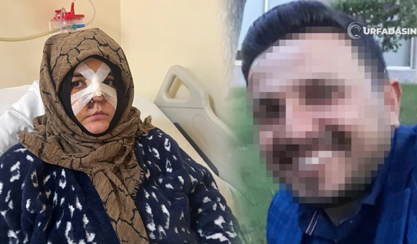 Eşinin Kaldırım Taşı İle Dövdüğü Şanlıurfalı Kadın: Çıkarsa Yarım Bıraktığı İşi Tamamlar