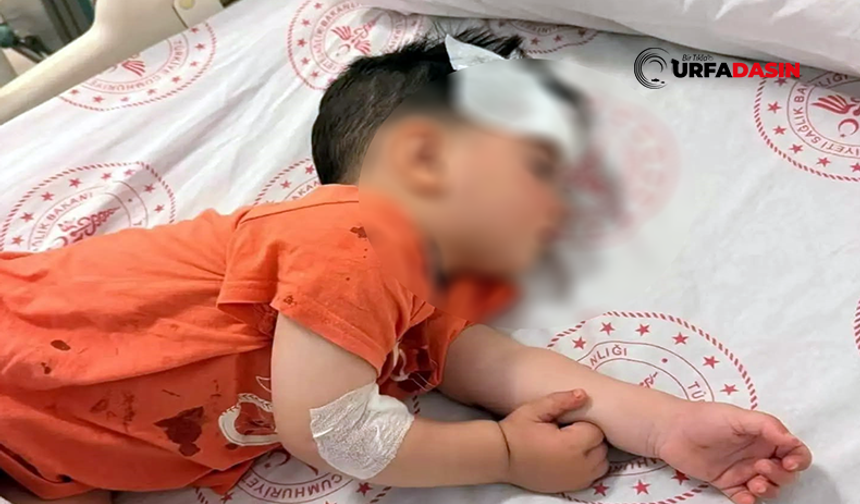 Şanlıurfa'da Başıboş Köpeklerin Saldırısına Uğrayan Çocuk Yaralandı