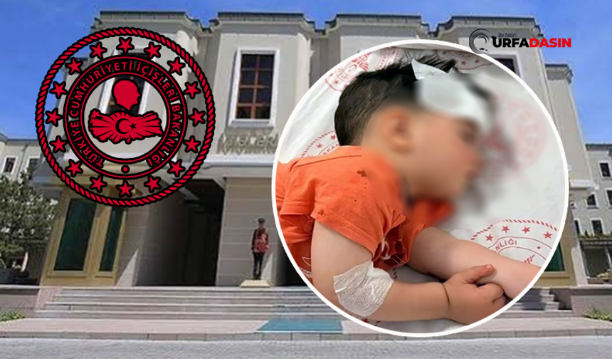 Şanlıurfa'da Çocuğun Köpek Saldırısı Sonucu Yaralanmasına İlişkin İnceleme Başlatıldı