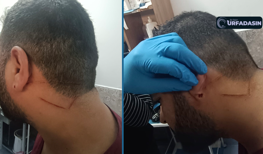 Şanlıurfa'da Sağlık Çalışanına Saldırı! Urfa'da Doktorlar İşte Bu Yüzden Kaçıyor