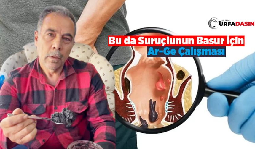 Şanlıurfa Suruçlu Mehmet Ağış, Basur Olanlara 15 Yıldır Doğal Çözümle Şifa Dağıtıyor