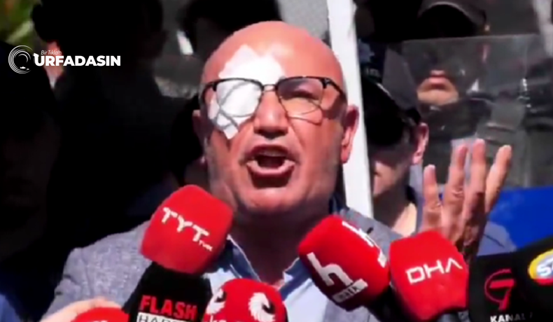 Tanal Tek Göz